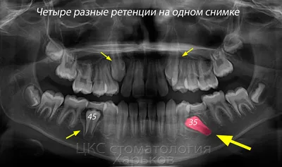 Испорченная карма плюс плохие гены.» — создано в Шедевруме