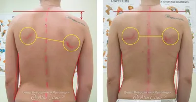 Позвоночник схемы : нормальная анатомия | e-Anatomy