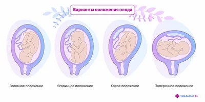 5 упражнений от боли в спине во время беременности – Академический  медицинский центр (AMC) - медицинская клиника в самом центре Киева