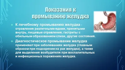 Пришлось делать промывание желудка: под Киевом женщина купила селедку и  нашла в ней ужасную «начинку» - ria-m.tv. РІА-Південь