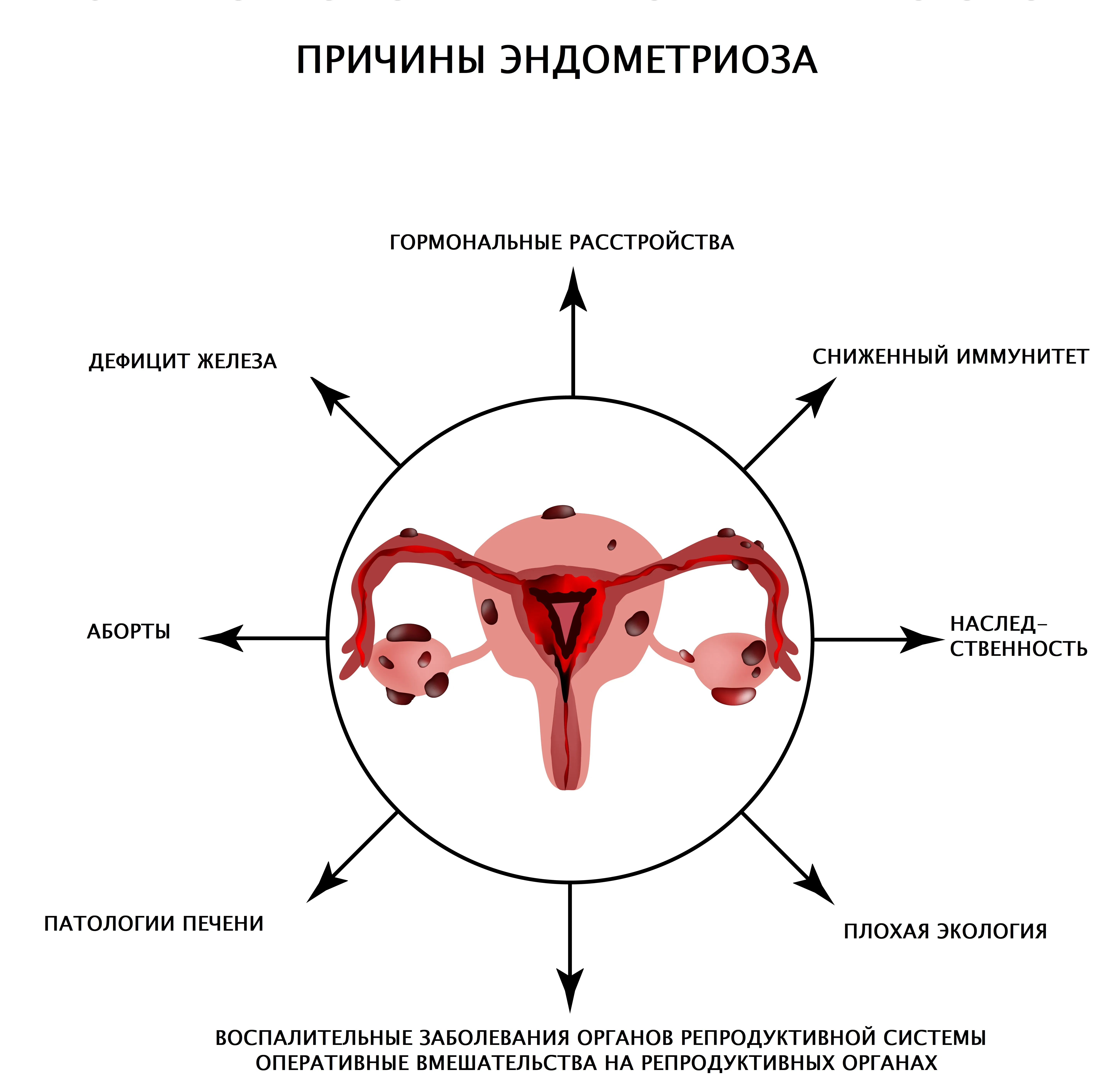 Признаки диффузной матки