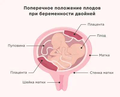 Чем занимается ребенок, пока находится у мамы в животе | (812) 337-12-12