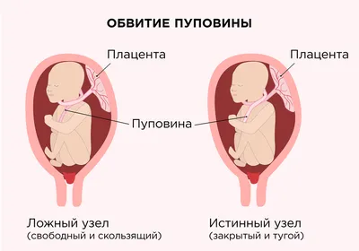 УЗИ скрининг 3 триместра беременности в СПб - Цена ультразвукового  исследования 32, 33, 34 неделя