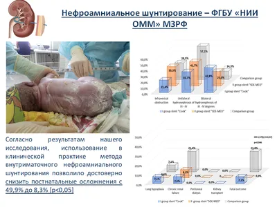 детальная медицинская иллюстрация ребенка в утробе. плод в утробе. анатомия  беременности Иллюстрация вектора - иллюстрации насчитывающей мать,  материнствй: 257292882