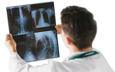 Как выглядит рак легких на рентгене, может ли рентген ошибаться в диагнозе  рак легких