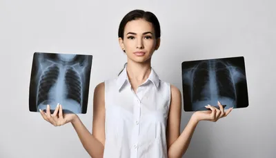 Расшифровка рентгена легких: простыми словами и снимками