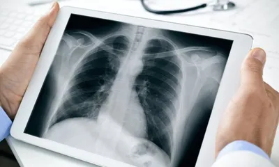 Рентген легких в Новосибирске сделать платно - цены на рентгенографию легких  в «Апекс»