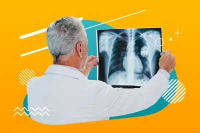 Записаться на рентген легких в Подольске по доступной цене