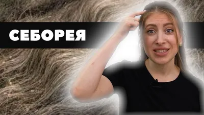 Лечение себореи и себорейного дерматита | Все о здоровье | Дзен