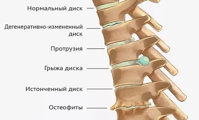 Цигун для шеи и плеч – Школа Мастера Ши Янбина