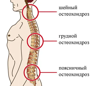 1С - Лечение остеохондроза шейного, грудного и поясничного отдела. |  Медицинские центры, адреса, телефоны