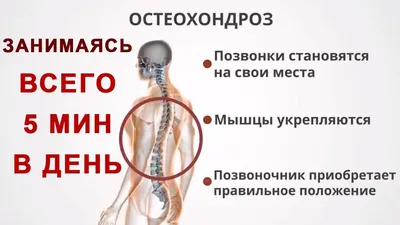 Как лечить давление при шейном остеохондрозе в Ростове