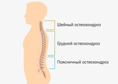 Массаж при остеохондрозе - Центр доктора Бубновского