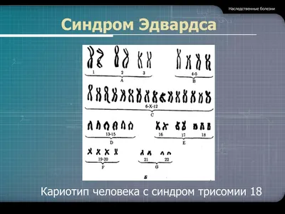 Сегодня День редких заболеваний