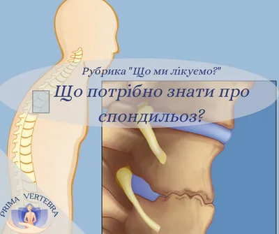 Оздоровление позвоночника в Грозном - ЧТО ТАКОЕ СПОНДИЛЕЗ❓🙌🏻 Не стоит  тянуть время, если у вас выявили спондилез❗️ Позвоночник – это фундамент  человеческого организма❗️ ❗️Итак, в позвоночник входит ряд позвонков,  соединяемых межпозвонковыми ...