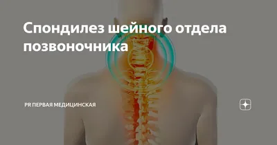 Спондилез пояснично-крестцового отдела позвоночника | Клиника Temed