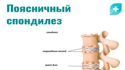 Спондилез у собак: причины, лечение и профилактика | VETSTEM