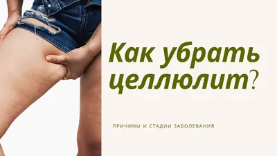 Средства от целлюлита: какие бывают, как работают, как часто использовать в  домашних условиях