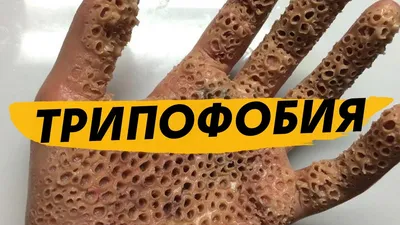 dekma – ТРИПОФОБИЯ (TRYPOPHOBIA) Lyrics | Genius Lyrics