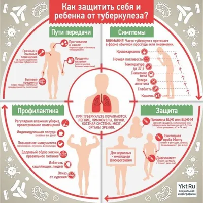 САНБЮЛЛЕТЕНЬ Туберкулёз - это серьёзно Профилактика заболевания Сове