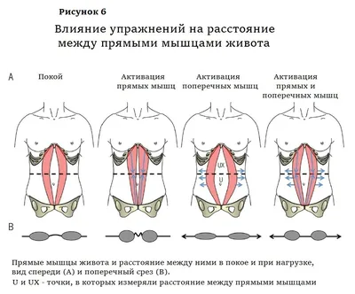 Упражнения, которые рекомендуют швейцарские врачи при диастазе - YouTube