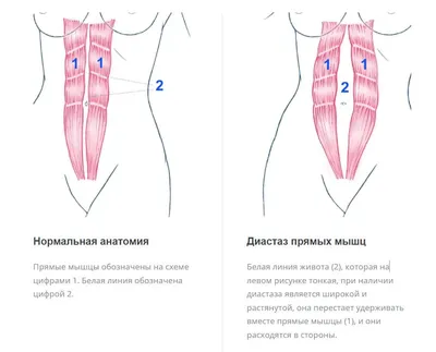 Упражнения Кегеля для женщин в домашних условиях