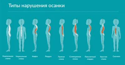 Комплекс упражнений для исправления осанки у детей — гимнастика для  правильной осанки | Блог фабрики Кузя