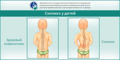 Вытяжение позвоночника - способ лечения сколиоза и нарушений осанки?