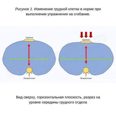 Физиотерапевтические упражнения при сколиозе - полный обзор семи основных  школ| Новости |Международная ассоциация мануальной терапии др. Типальдоса -  FDM Ukraine