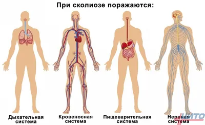 10 лучших упражнений при сколиозе у взрослых: комплекс эффективных  тренировок для укрепления мышц спины