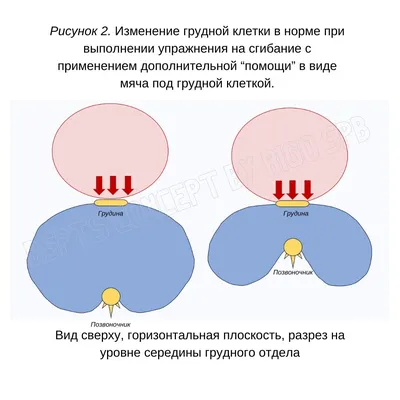 Лечебная физкультура в санатории «Виктория»