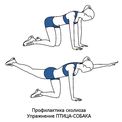 S-Образный сколиоз 1-2-3 степени, причины, лечение грудо-поясничного отдела  позвоночника