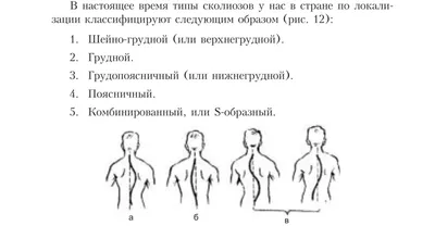 Что такое доска Евминова? Как это лечит сколиоз?