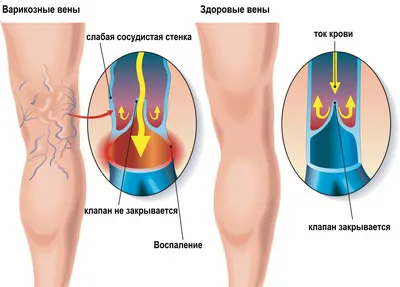 Кровообращение. (Тема 3.2) - презентация, доклад, проект