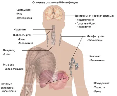 Вирус Иммунодефицита Человека Или ВИЧ. Анатомия Вириона СПИДа. Векторная  Диаграмма Клипарты, SVG, векторы, и Набор Иллюстраций Без Оплаты  Отчислений. Image 30925598