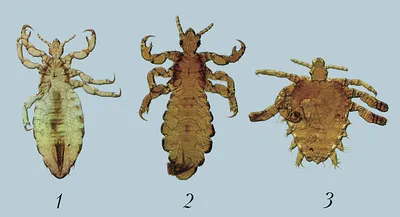 Вши на голове: вша я дрожащая или право имею | Royal Medical Traiding |  МЕДИЦИНА И ТЕХНИКА | Дзен