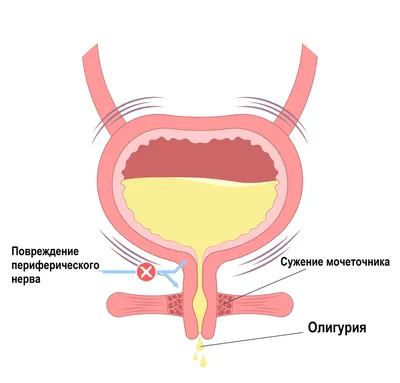 Афтозный стоматит у взрослых и детей: причины, симптомы, лечение