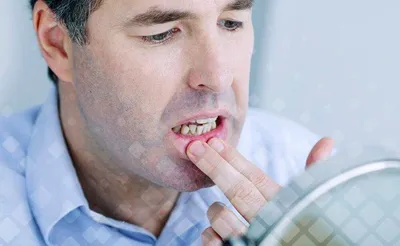 Средства и методы гигиены полости рта. Как ухаживать за полостью рта