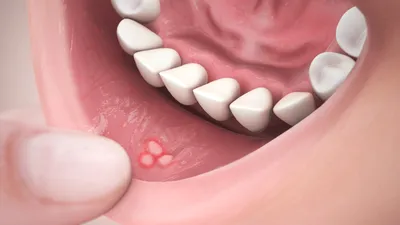 Профилактика стоматологических заболеваний - УЗ \"15-я городская поликлиника\"