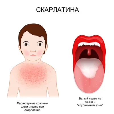 20 марта — Всемирный день здоровья полости рта — Барановичская центральная  поликлиника