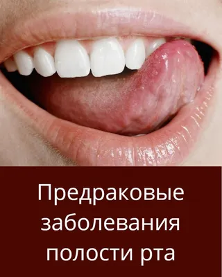 Полезные советы | Лечение полости рта, Полезные советы, Полости