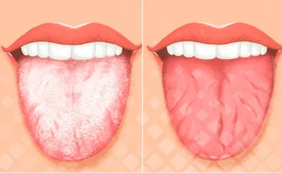 Курение и здоровье зубов - Блог компании Revyline