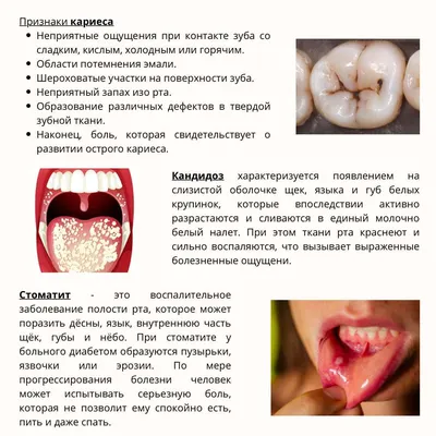 Что делать при появлении молочницы во рту | Стоматология Smile-at-Once |  Дзен