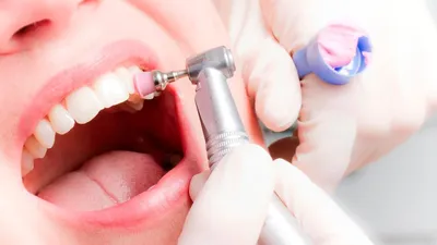 Методы профгигиены полости рта