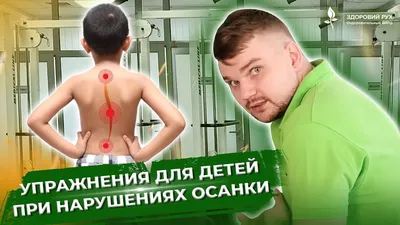 Сколиоз: этиология, классификация, диагностика, лечение - Vertebra