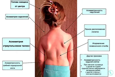 Комплекс упражнений для детей для спины и позвоночника — зарядка для мышц  спины | Блог фабрики Кузя