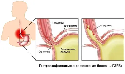 ЖЕНСКАЯ ЙОГА ДОМА on Instagram: \"КОВАРНЫЕ УБИЙЦЫ ЖКТ Знаете, кто первым  «седеет» от наших страхов, тревог и волнений? И вовсе это не голова, а …  наш кормилец - ЖКТ Казалось бы, ему-то